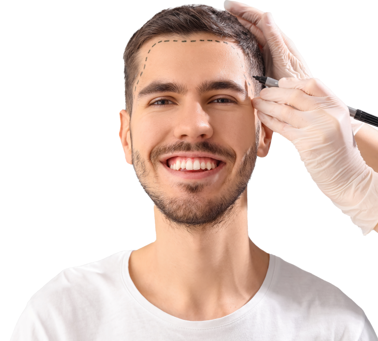 FUE Hair Transplant