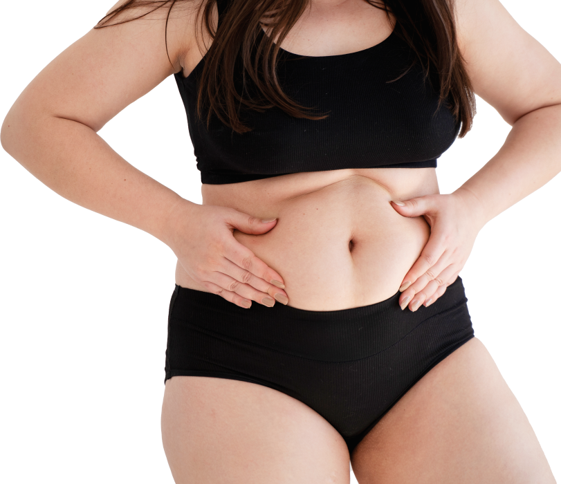 Gastric Balloon